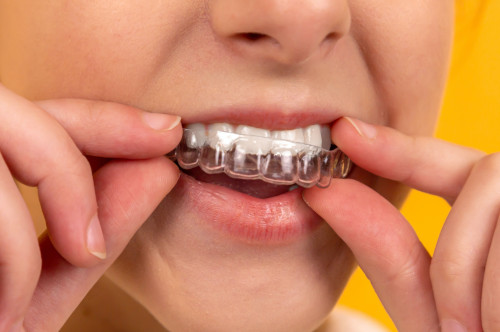 Aparato dental transparente