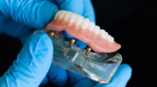 Prótesis dental removible Galapagar